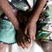 Ghana heightens surveillance to combat Mpox disease