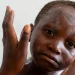 How worried should we be about mpox?