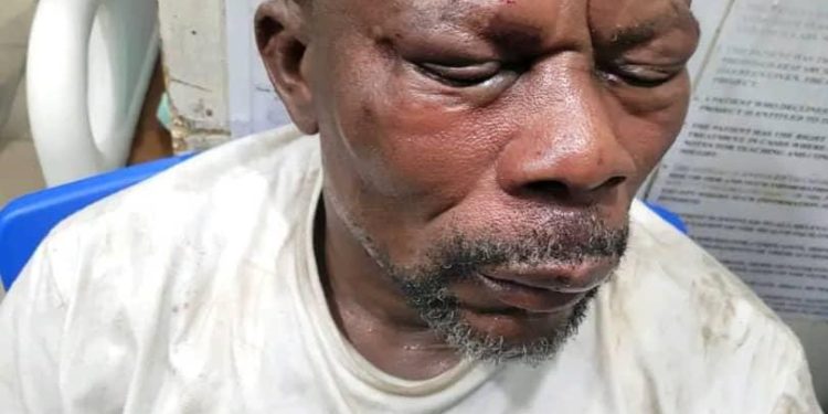 Effutu NDC Vice Chairman escapes lynching; others injured in Post-Election violence, two arrested