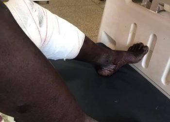 Armed attack on bus leaves several injured on Bolgatanga-Walewale highway