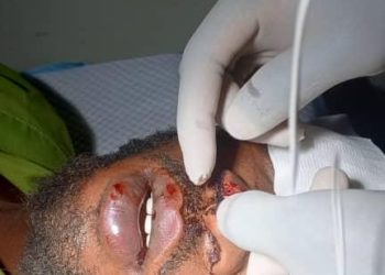 E/R: Two dead in mining pit collapse at Osino