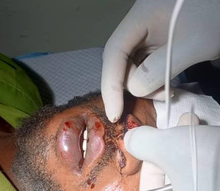 E/R: Two dead in mining pit collapse at Osino