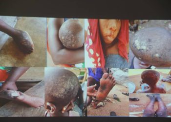 E/R: 1,453 people identified with skin diseases