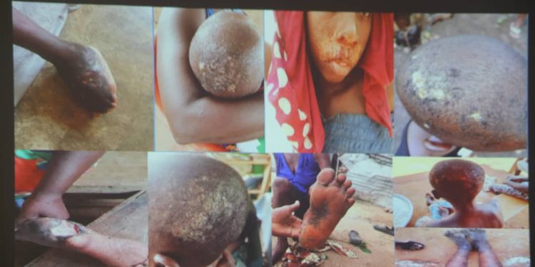 E/R: 1,453 people identified with skin diseases