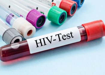 Ashanti tops Ghana’s HIV population estimates