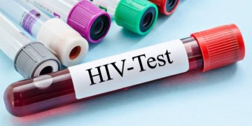Ashanti tops Ghana’s HIV population estimates