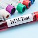 Ashanti tops Ghana’s HIV population estimates