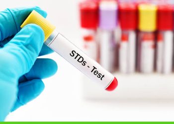 Failure to disclose STI status before Sex is a Crime – DOVVSU Director