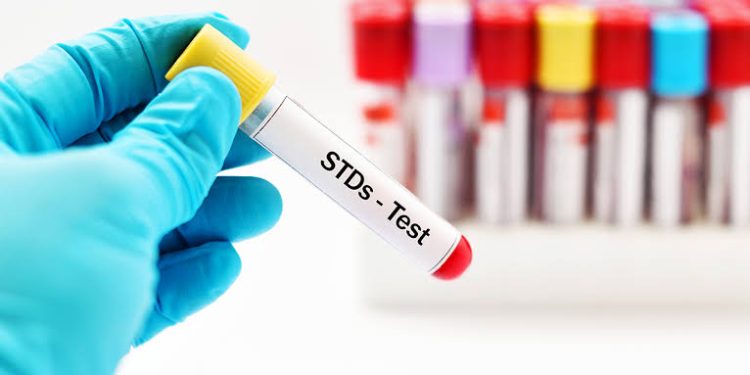 Failure to disclose STI status before Sex is a Crime – DOVVSU Director