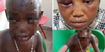 Nigerian national jailed 15 months over assault of daughter