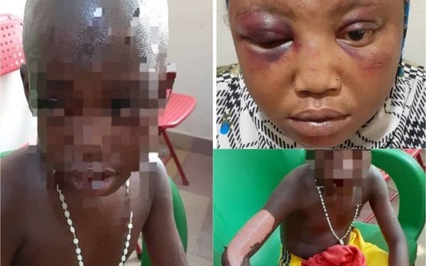 Nigerian national jailed 15 months over assault of daughter