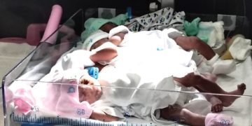Surrogate mother delivers quadruplets – Rare in assisted reproductive technology