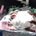 Surrogate mother delivers quadruplets – Rare in assisted reproductive technology