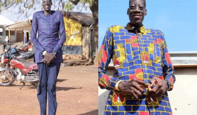 Awuche dies at Tamale Teaching Hospital after long battle with gigantism