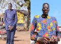 Awuche dies at Tamale Teaching Hospital after long battle with gigantism