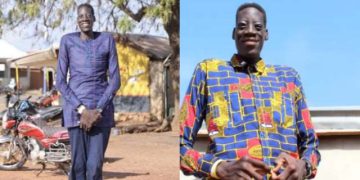 Awuche dies at Tamale Teaching Hospital after long battle with gigantism