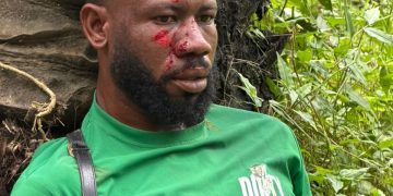 Victim Appeals to IGP for Justice After 3 injured, 3 Vehicles Vandalized at Akyem Pameng over Mining
