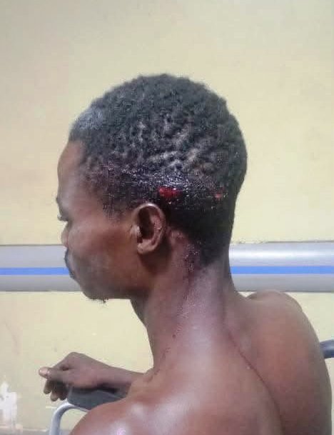 injured victim of violence
